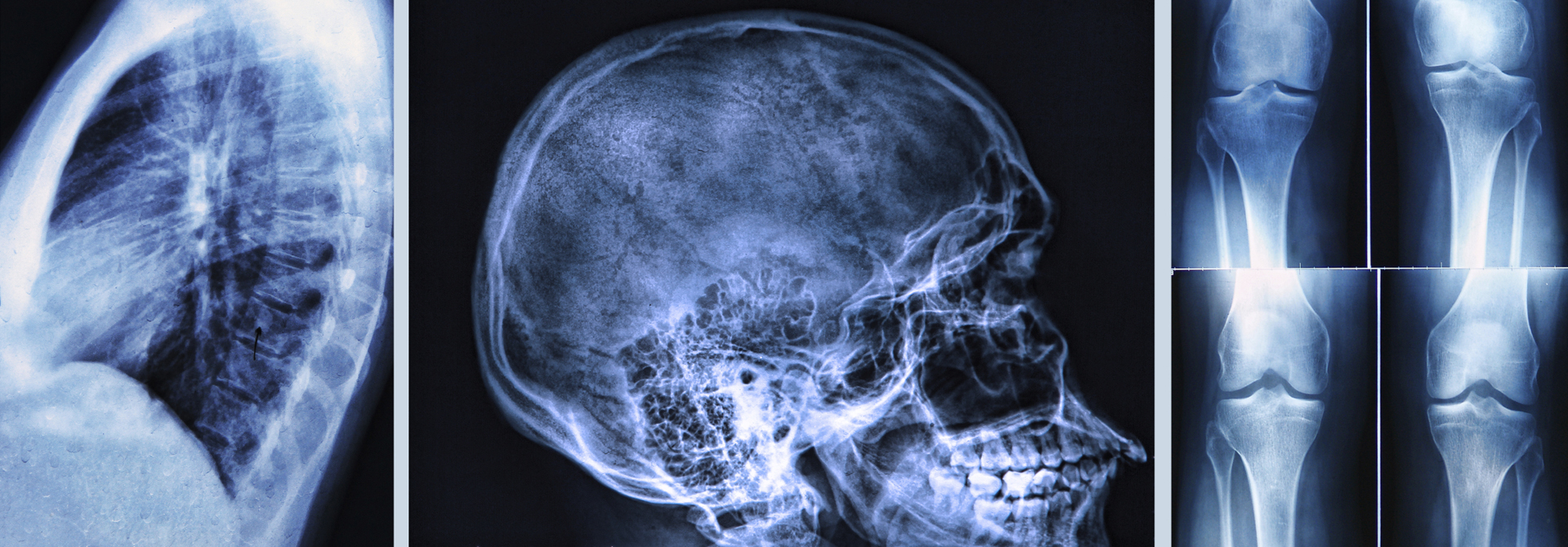 Radiography of Human Bones: x-ray and MRI scans